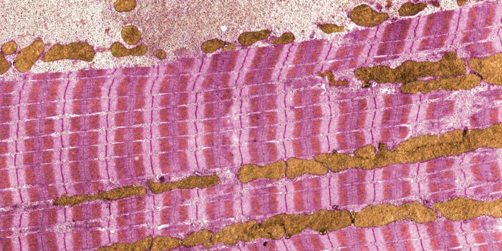 muscle-ultrastructure muscle-ultrastructure
